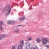 Example of H&E Stained Tissue